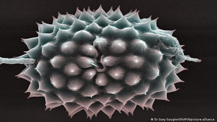 Ragweed pollen under the microscope