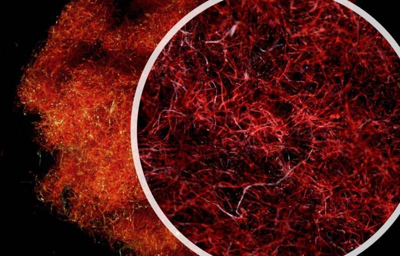 Microscopy of cotton (red) and polyester (black) fibers collected from tumble dryer exhaust. Credit: Lant et al., 2022, <i>PLOS ONE</i>, CC-BY 4.0 (creativecommons.org/licenses/by/4.0/)” width=”800″ height=”513″/><figcaption class= Tumble dryers release microfibers into environment at levels comparable to washers